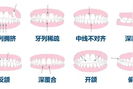 口腔溃疡、牙龈肿痛……看牙该挂哪个科？这份挂号指南请收好图片