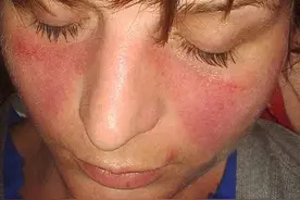 做噩梦，可能是免疫系统正在攻击你的身体图片