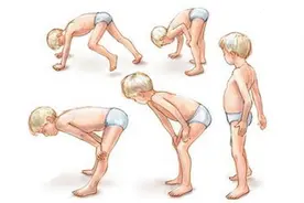 先天性肌营养不良的康复治疗丨贤医健康说图片