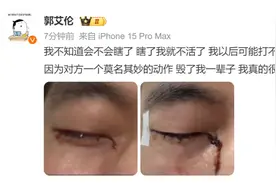 郭艾伦喊话：我真气不过！以为我眼珠没有了图片