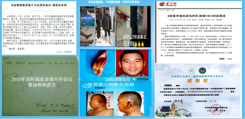 菏泽博爱医院首席专家钟国栋当选山东省医学会手外科学分会、显微外科学分会副主任委员 引领菏泽显微外科事业再攀高峰