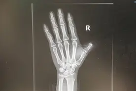 尹主任，来活了，难度很大！图片