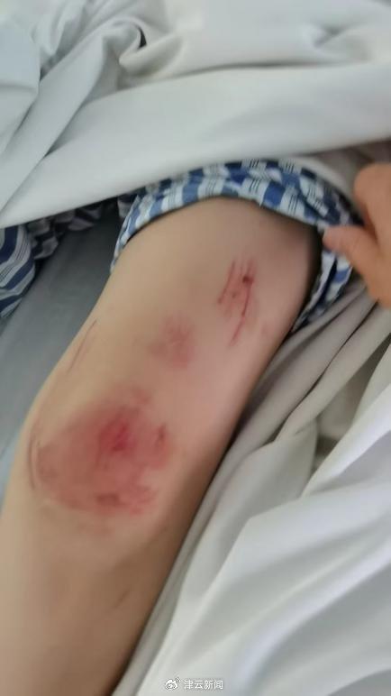 女子遭家暴开车逃跑撞死丈夫 女方父亲：在等二审结果 望判女儿无罪