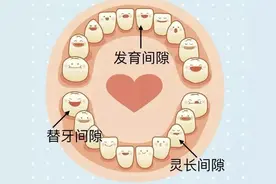 牙齿间隙，要不要重视？图片
