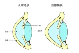 健康中国看山西：山西爱尔眼科医院 这一次，是角膜等人……图片