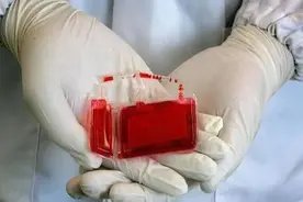 境外淋巴瘤患者血入境上海，加工后再出口回输，药企“地狱级”难题今走通图片