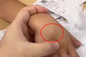 担心的事情发生了！福州一小学生，拍“烟卡”进了医院！图片