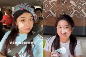 网红博主高反后“肿”若两人，医生：可以预防！图片