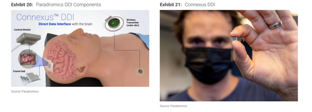 脑机接口——人与AI“共生”