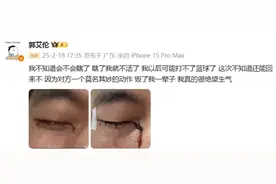 眼科专家解读郭艾伦伤情：有二次手术甚至失明可能图片