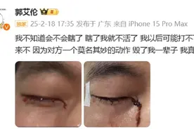 眼科专家解读郭艾伦伤情：有二次手术甚至失明可能图片