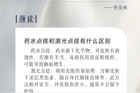潮颜社日签 | 药水点痣和激光点痣有什么区别？图片