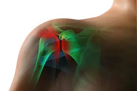 肩关节脱位，到底是怎么回事？图片