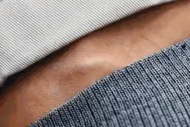 已有人中招！户外踏青要警惕！图片