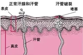杭州男子总被妻子嫌弃滂臭，一查真有大病！图片