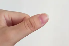 气血好有8个“小月牙”，对照看一下你有几个？图片