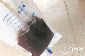 “篮球少年”现暗红色血尿 小心胡桃夹综合征图片
