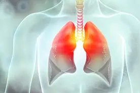 世界防治结核病日 哪些人需要主动筛查？图片