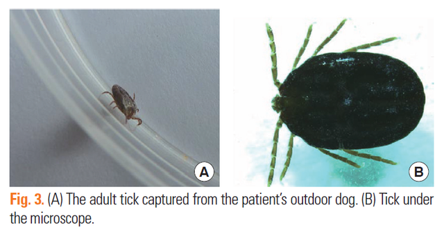 被这种小虫子叮咬后又吃了牛肉汉堡，47 岁飞行员竟因此突然死亡