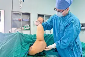 一女子右臂淋巴水肿长达20年肿如皮球 改良Charles减容手术联合抽脂手术帮其恢复如初图片