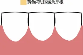 24岁深圳女孩中招“不可逆”牙龈退缩！这种错误刷牙速自查图片