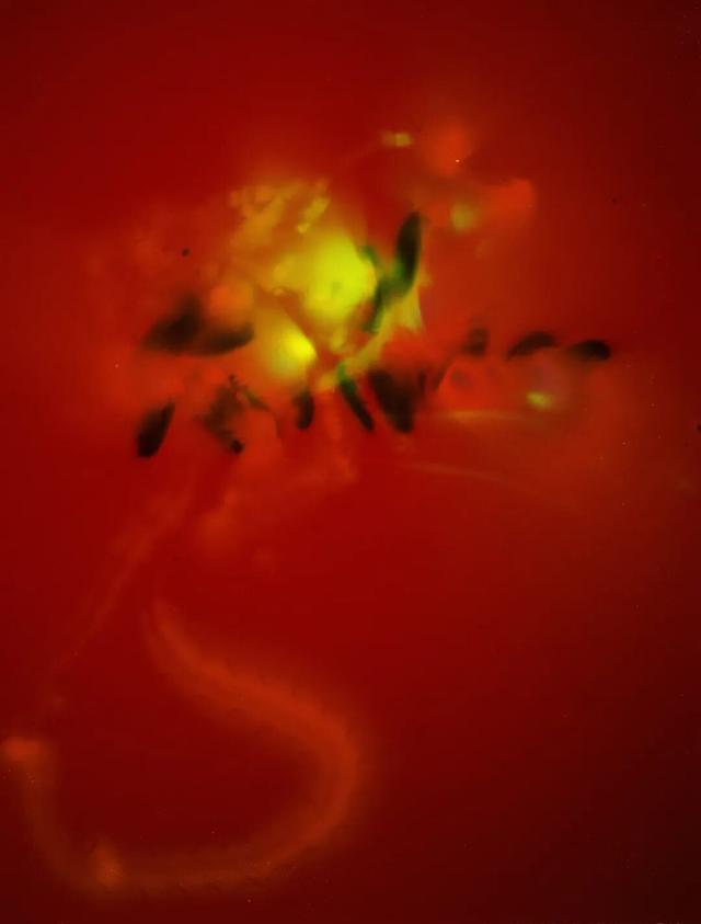 跨越那二十多分钟：集美·阿尔勒的十一年