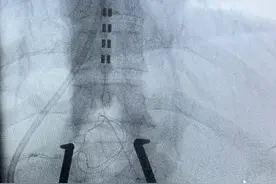 西安市中心医院应用新方法 成功助力昏迷患者促醒图片