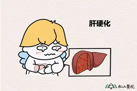 松山医院：有这些肝硬化早期信号 要尽快就医检查图片