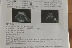 胎儿检出脐带缠绕数天后死亡，孕妇家属称医生风险评估不到位图片