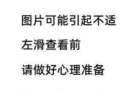 夏季手上反复起水泡？奇痒无比还脱皮？这可能是汗疱疹在作怪！图片