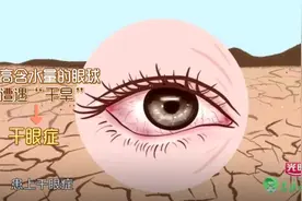 眼睛怕光、流泪、刺痛？教你4招缓解干眼症！总有一招适合你！图片