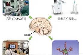 潍坊市人民医院：颅脑肿瘤精尖技术，引领生命新希望图片