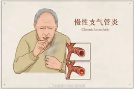 秋冬季小心慢性支气管炎急性加重图片
