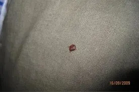 慎点！可随衣服行李传播！多国爆发床虱危机，已传入亚洲图片