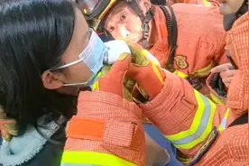 上海急诊医生紧急求助！病人嘴唇被“咬”住了……图片