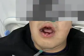 小伙在业主群脏话“骂”物业，遭数人上门连扇嘴巴？警方正在调查图片