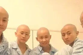 山东临沂姐弟重度烧伤，妈妈和4个姨妈剃光头为他们捐肤植皮图片