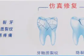 网购牙膏宣称能修复蛀牙，消费者用后耽误治疗起诉赔偿获部分支持图片