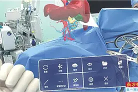 虚拟现实重构“器官” 医生有了“透视眼”图片