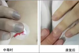 食用腌菜竟可能有中毒风险！这样吃安全又健康图片