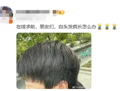 V观话题丨不同位置的白发反映不同健康问题，你哪个位置的白发最多？图片