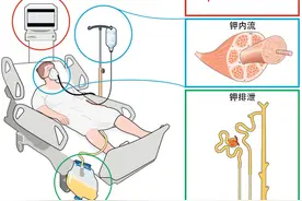 值班必备 | 高钾血症急诊处理要点图片