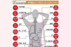 发现肿瘤标志物升高，该怎么办？图片