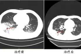 近期高发！当心吹空调也能吹出“致命”病图片
