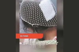 杀伤力极强！警惕“鲨鱼夹”变“凶器”开车或运动时不建议佩戴图片