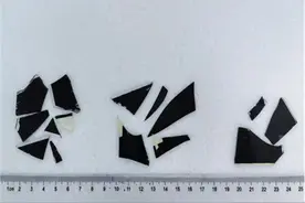 青岛一男子误吞多片碎玻璃，山东大学齐鲁医院（青岛）在多学科协作下成功挑战高难度的多发性消化道异物取出术图片
