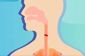 建议转存！最直观海姆立克急救法视频封面