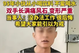 小伙双手长满“石头”肿如萝卜，只因这个多年习惯……网友热议！图片