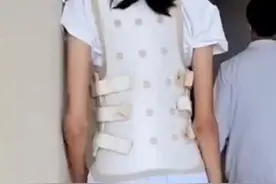 13岁女孩身高超170被确诊“天才病”图片