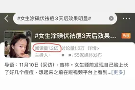 “战痘”又有新招，碘伏祛痘究竟靠不靠谱？|网红说法求真图片